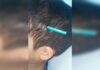 Menino de 9 anos fica com lápis cravado na cabeça após ataque de coleguinha