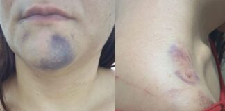 Mulher é ferida após discussão e homem acaba preso em Nova Aurora