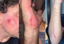 Discussão por dinheiro termina em agressões com facão na madrugada em Toledo