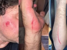 Discussão por dinheiro termina em agressões com facão na madrugada em Toledo