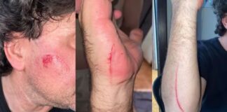 Discussão por dinheiro termina em agressões com facão na madrugada em Toledo