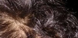 Mulher é atingida por pedra e fica ferida no Jardim Concórdia, em Toledo