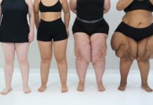 Dor, inchaço e vergonha: o sofrimento silencioso do lipedema45) 99947-0937