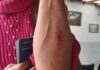 Marido chega em casa embriagado e após discussão casal fica ferido em Toledo