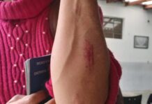 Marido chega em casa embriagado e após discussão casal fica ferido em Toledo