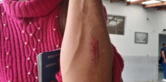 Marido chega em casa embriagado e após discussão casal fica ferido em Toledo