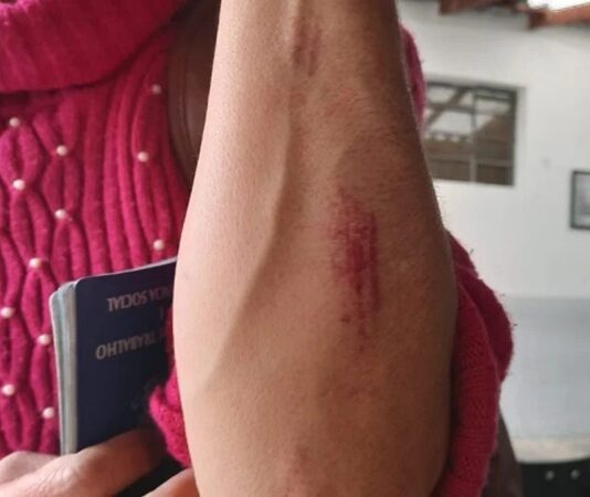 Marido chega em casa embriagado e após discussão casal fica ferido em Toledo