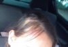 Mulher fica ferida após levar garrafada na cabeça do marido bêbado em Marechal Rondon