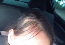 Mulher fica ferida após levar garrafada na cabeça do marido bêbado em Marechal Rondon
