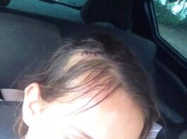 Mulher fica ferida após levar garrafada na cabeça do marido bêbado em Marechal Rondon